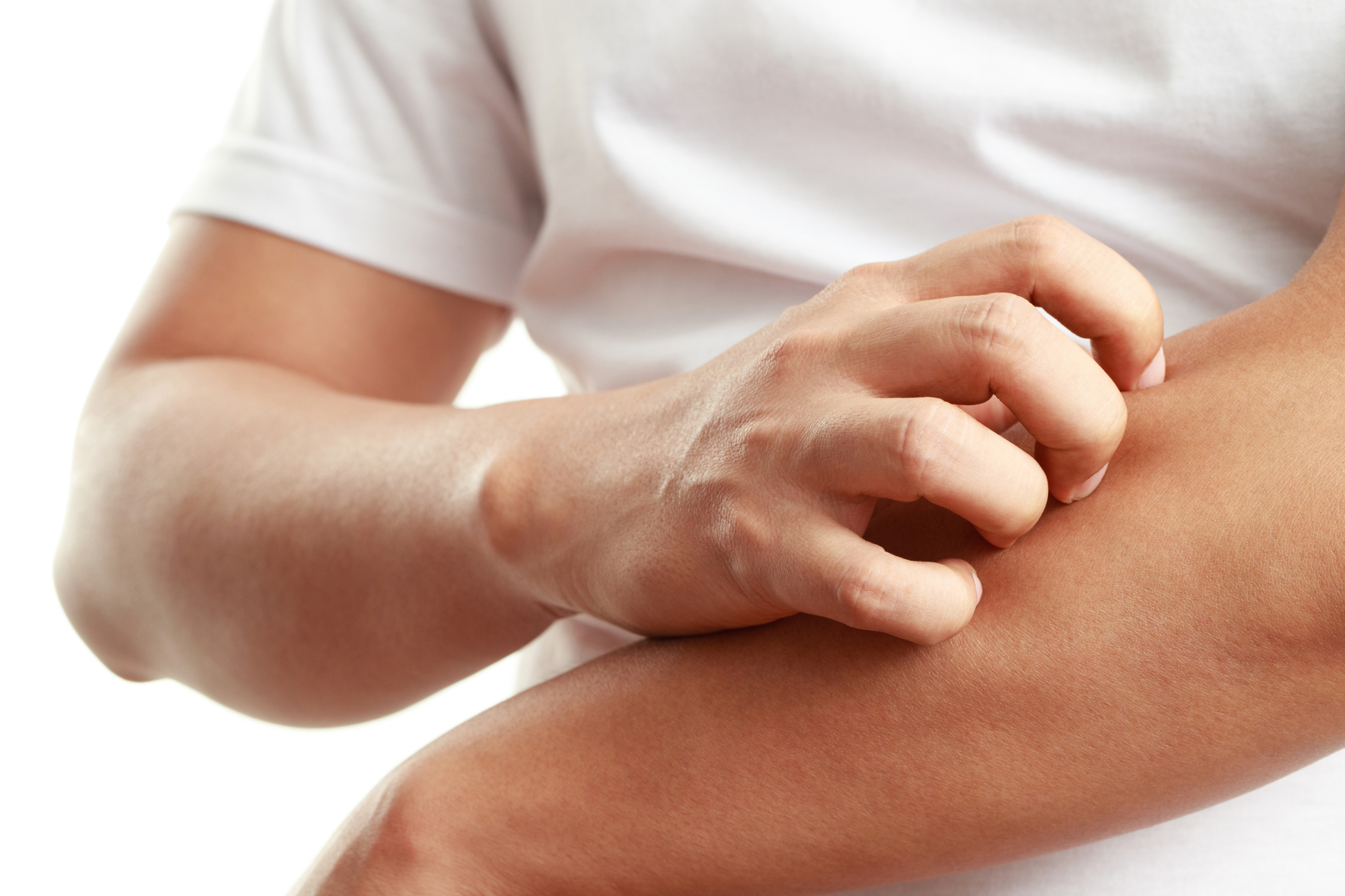 Closeup of a man scratching his arm